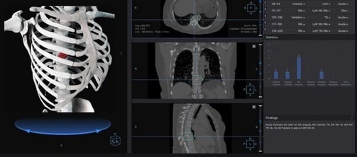 radiografías con inteligencia artificial